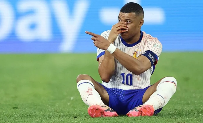 Kylian Mbappé sufre una fractura de nariz y es trasladado al hospital