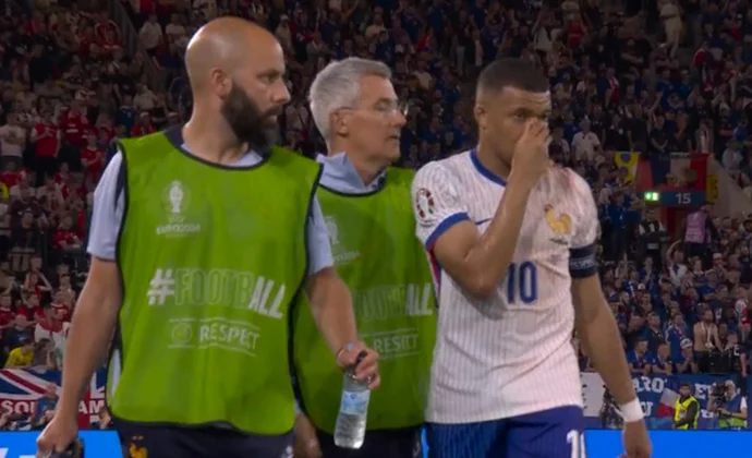 Mbappé tiene que ser sustituido por una hemorragia nasal