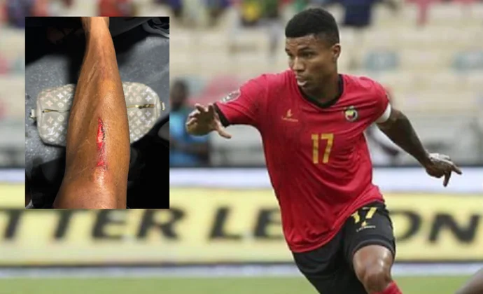 Reinildo, pendiente de evolución por una magulladura en la tibia