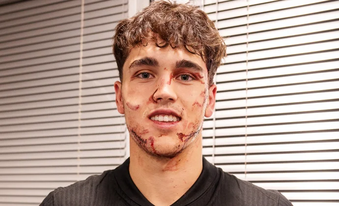 Cubarsí se ve apto para jugar el domingo y será evaluado en las próximas horas