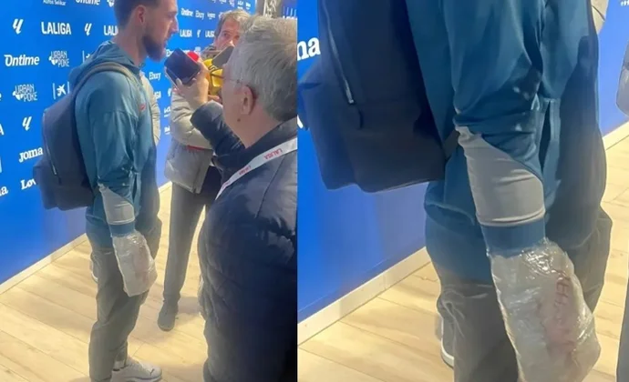 Oblak terminó con hielo en la mano y queda pendiente de evolución