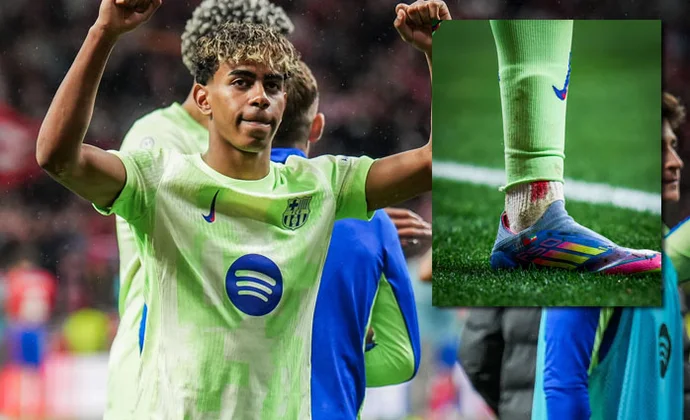 El Barça transmite normalidad y tranquilidad por la sangre del tobillo de Yamal