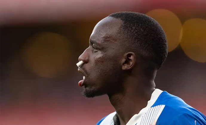 Moussa Diarra sufre una fractura de nariz