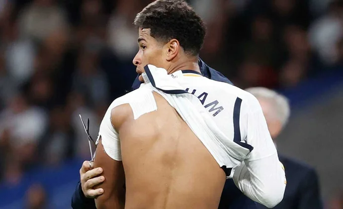 Jude Bellingham se operará hoy en Londres y estará un tiempo de baja