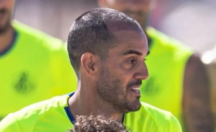 Juanmi, tercer amistoso que se pierde por un tratamiento capilar