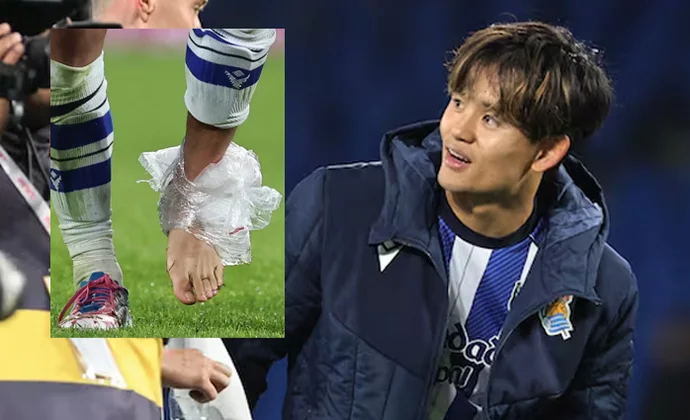 Kubo jugó con dolor en el tobillo por segundo partido consecutivo