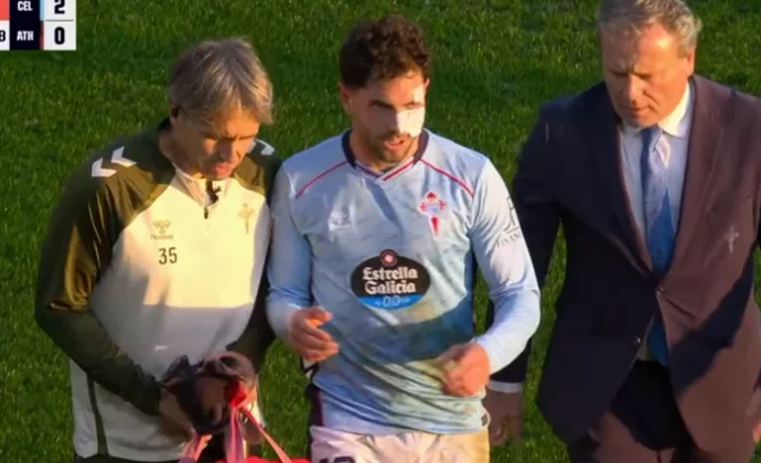 Javi Rueda fue sustituido con magulladuras en la cara