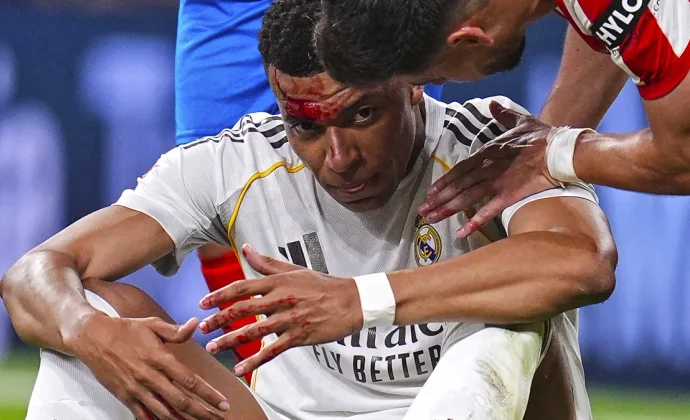 El Madrid se desangra con Mbappé