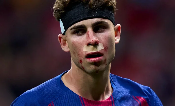 Fermín guardará reposo unos días por un corte en el labio